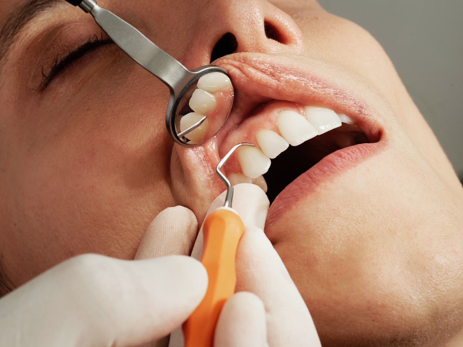Gum Pain: Causes and At-Home Treatments